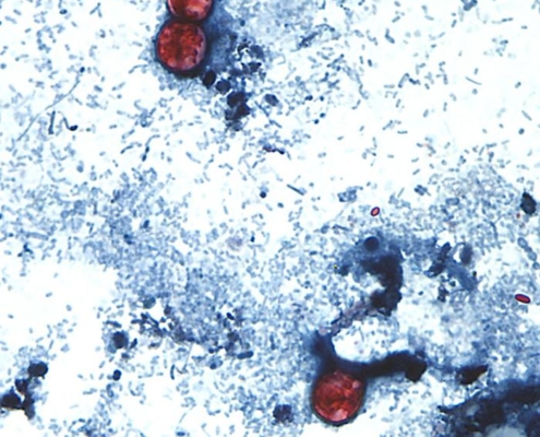 cyclospora lawyer microscope image