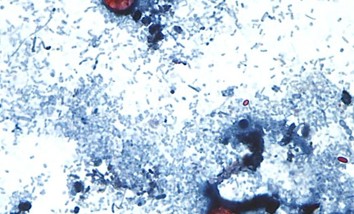cyclospora lawyer microscope image
