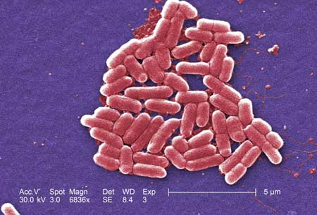Magnification of E. coli bacteria