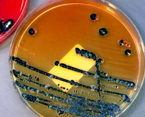 Salmonella bacteria (black colonies) mixed with other enterobacteria grown on an agar plate.