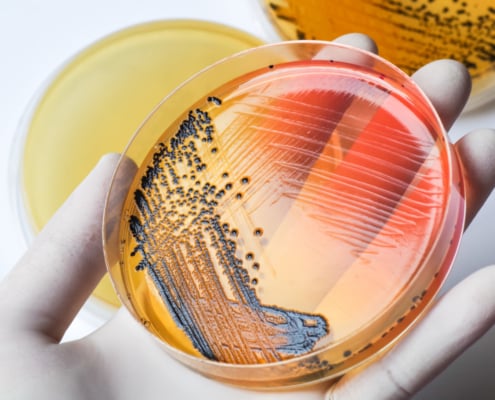Salmonella lawyer -gloved hand holds petri dish that shows positive Salmonella result