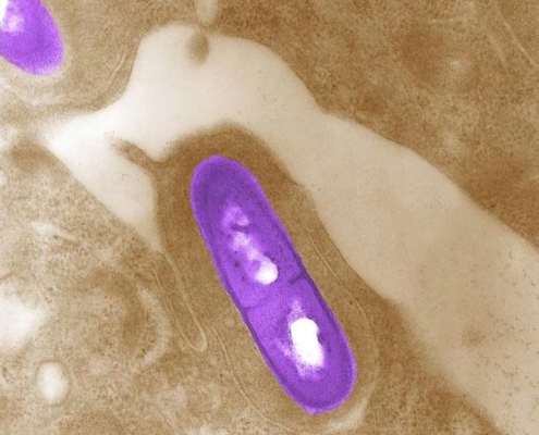 listeria bacteria - CDC file image